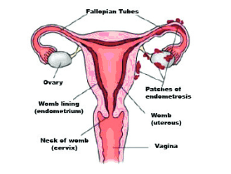 Diagram of the womb
