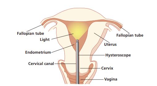 Diagram of female anatomy